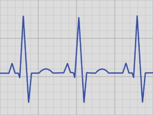 ecg, echo kardiogram, rhythm